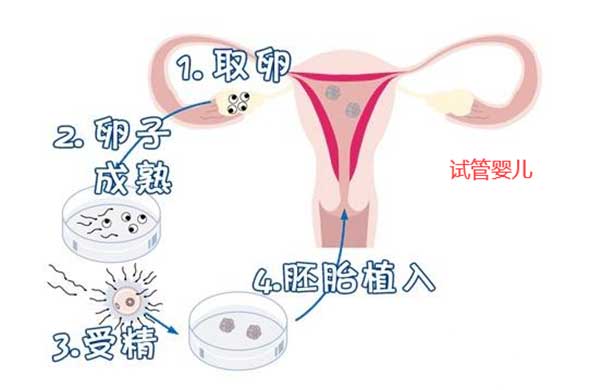 为什么都选择试管婴儿而不是人工受精?(图2)