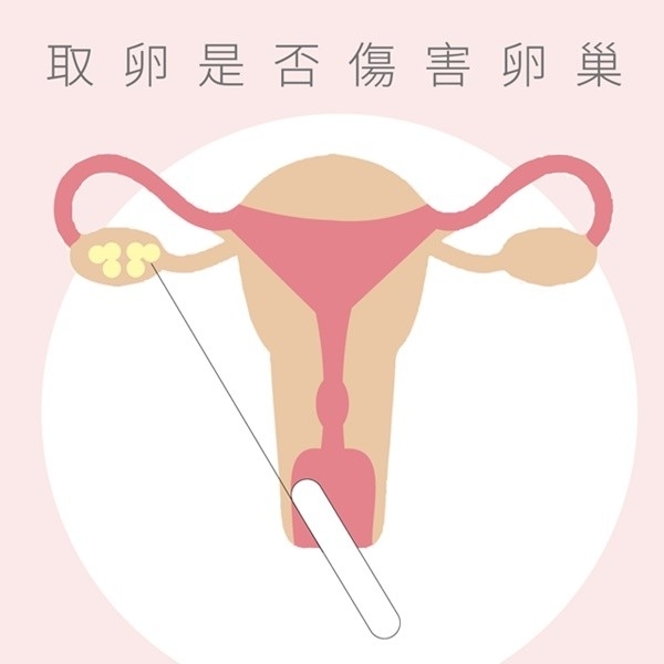试管婴儿取卵感觉很可怕？ 会不会伤害卵巢？
